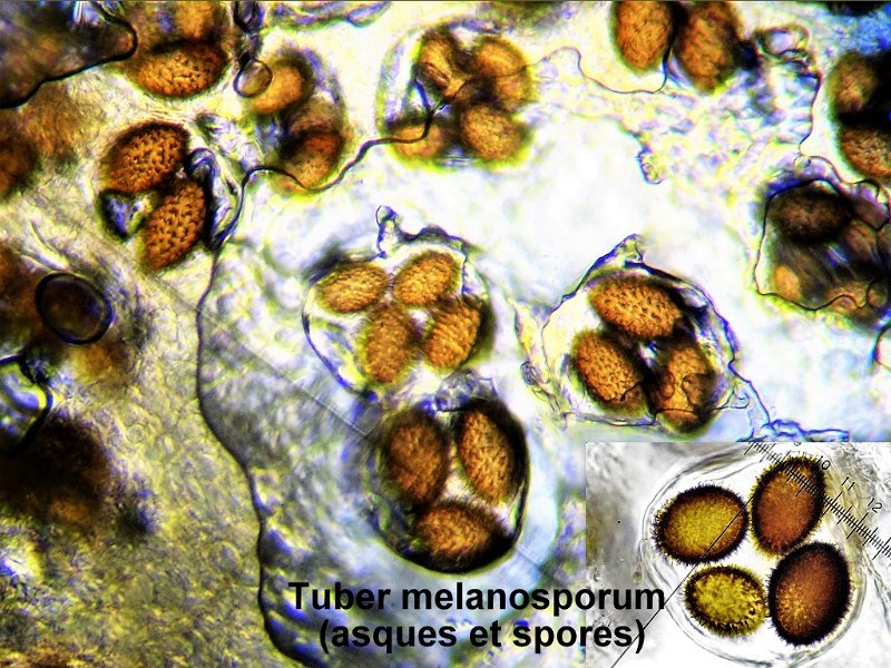 Tuber melanosporum-amf1903-asques et spores.jpg